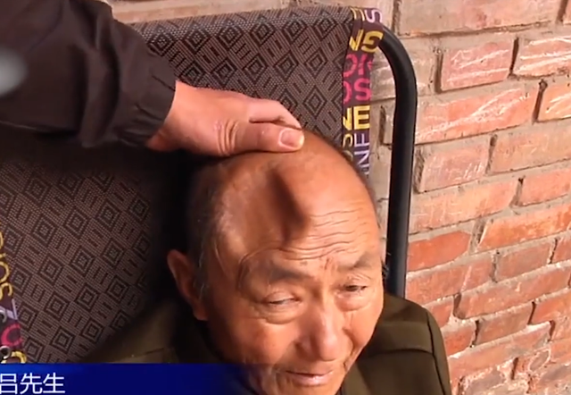 河南70岁老人，住养老院20天头部出现大坑，院方：他是自己撞的！