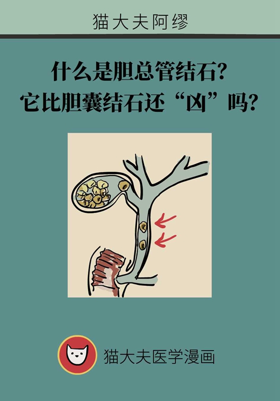 胆总管结石怎么治疗？一文读懂