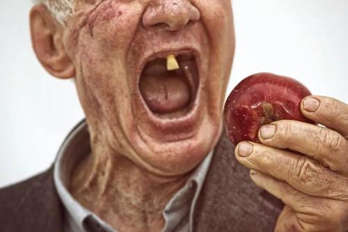 老人缺牙越厉害越容易老年痴呆